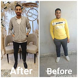 Therapeutic nutrition